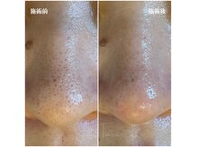 サラティアラ(SaraTiara)