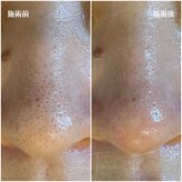 サラティアラ(SaraTiara)