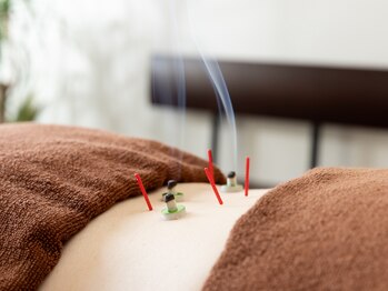 はな鍼灸院/鍼好きな方へ