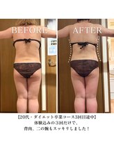 ヨサパーク リバティ 池袋東口店(YOSA PARK Liberty)/Before&After