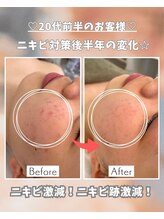 エステサロン 凛/親子でエステ