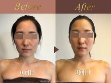 オーシャン(Ocean)/全身美容矯正90分/週1回×3回