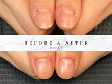 ツリートップ(Tree Top)