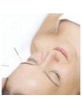 桜琴鍼灸治療院 赤坂店/美容鍼