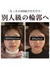小顔矯正＋リンパケア￥7700→6600　【顔の歪み /左右差 /頭痛 】