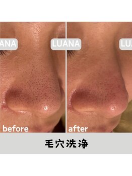ルアナ 北谷店/毛穴洗浄毛穴ケア 《沖縄/北谷》