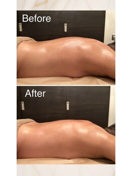 フィール(feel)/Before/After リンパマッサージ