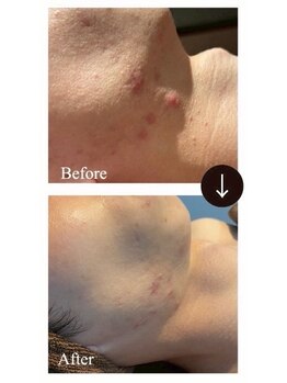 マルサンカクシカク(○△□)/