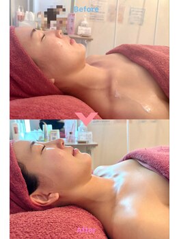 インディバ 恵比寿(INDIBA)/インディバフェイシャル