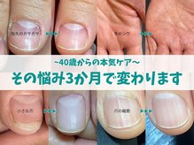 キラリネイル(KIRARINAIL)