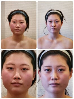 金梨花サロン/小顔コルギ・頭蓋骨矯正