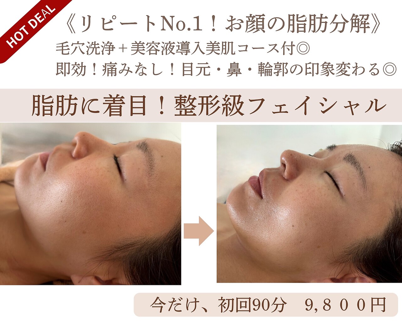 西宮市で毛穴ケアが人気のエステサロン｜ホットペッパービューティー