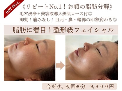 エルブラン(Herb ame)の写真