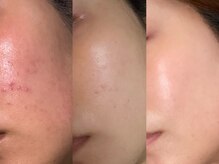 アルテ 神戸(Arte)/