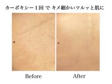 ナチュラーレ 天王寺店(Naturale)/美肌ニキビケア背中ブライダル