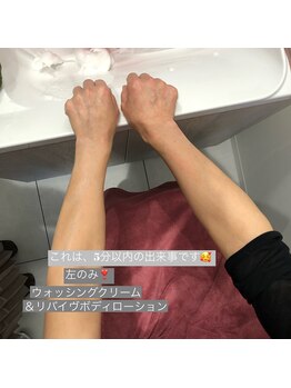 サロンシャイン(Salon Shine)/ＲＥＶＩホームケア体験