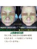 たるみケア★表情筋リフトアップ