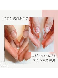 広がっている爪を補正できる