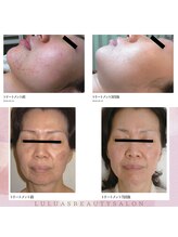 ルルアス 銀座(LuLuAS)/韓国発祥のムルトクスピール