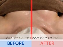 エル 麻布十番(LllL)/【痩身/小顔】首肩デコルテ流し