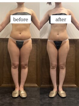 パリスヒロトン(PARIS HIROTON)/-11kg達成！まだまだ進行中！