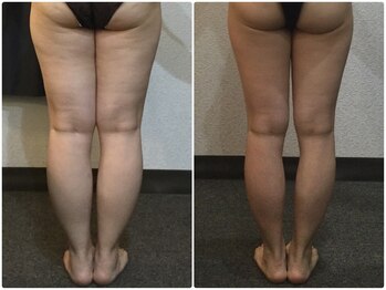 美容整体ウェリナ あま甚目寺院/小顔矯正/骨盤矯正/美脚サロン