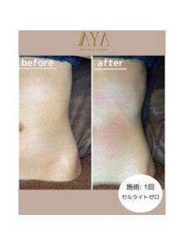 アヤエステティックサロン 綱島店(AYA)/理想のくびれに!!