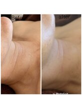 private salon Ponola【ポノーラ】/ゾンビマスク