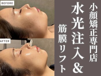 【肌管理×小顔・毛穴改善フェイシャルサロン】MavY.草津店【4/21 OPEN(予定)】/たるみケアマシンも多数☆