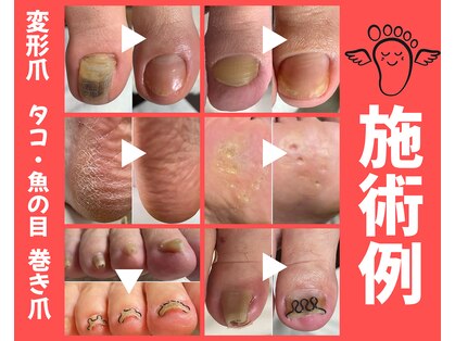 ランカ(RUNKA)の写真