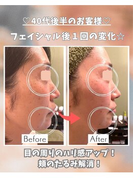 エステサロン 凛/目元と口周りは年齢が出るところ