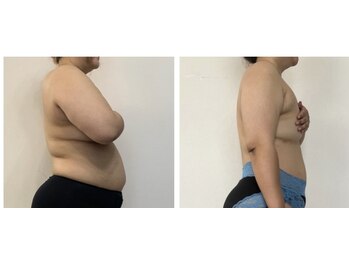 アンリ(Anli)/2ヶ月