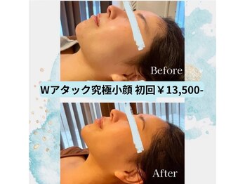 ウナ デ リンゴル 恵比寿店(UNA de Ringol)/当店1番人気小顔メニュー¥13500