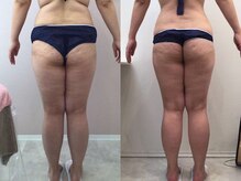 ビラ 銀座店(BILA)/キャビラジ