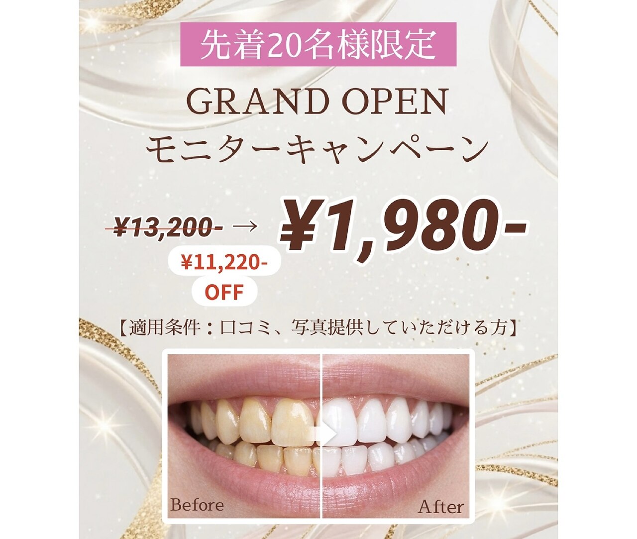 今日限定ラスト1台！大幅値下げ！！最新セルフホワイトニング ダブルカラット 南行徳店(W carat)｜ホットペッパービューティー