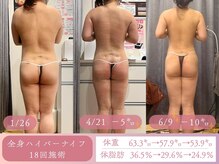 スリムプロ 天王寺店(Slimpro)/モニター様ビフォーアフター