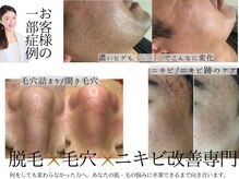 サロン イナンナ(Salon INANNA)