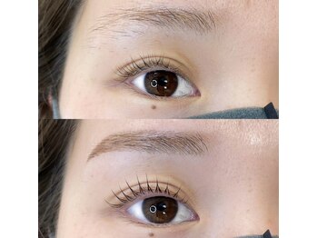 ノンチェ(Nonche)/マスク美人セット【西北/西宮】