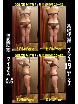ドルチェヴィータ(DOLCE VITA)/痩身モニター様　半年間