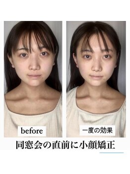 ビジュー(bijoux)/一度のビオアフ２