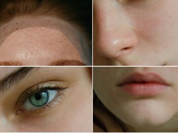 トロワ(TROIS)の写真/医療機関提携×看護師施術で、360度どこから見られても美しい小顔と美肌を叶える★一生に一度の特別な日に