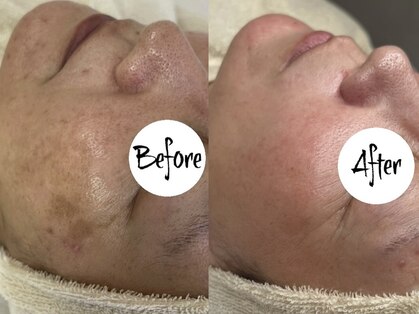 ラヴィ(Ravi)の写真