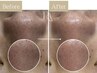 【OPEN記念¥1000OFF】毛穴洗浄＋フェイシャルパック｜黒ずみ・ざらつき改善