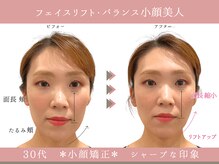 グレースエール トータルビューティーサロン(Grace Aile)/＊戻らないバランス小顔矯正＊