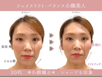 グレースエール トータルビューティーサロン(Grace Aile)/*戻らないバランス小顔矯正*