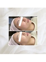 プリマプリート 名駅店/VOSサロンケア