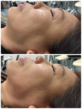 フォトビズ/レッドショット１回