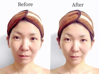 プラスアルファ(PlusAlpha)の写真