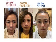 ビューティサロン ポノ(Pono)の雰囲気（人気の小顔フェイシャル！ノーファンデ/42歳/サーファー）