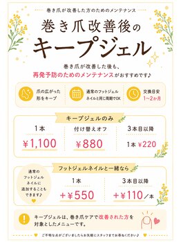 にっこりネイル/巻き爪ケア後の再発防止ケア♪